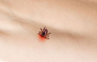 Long Island Tick Spraying